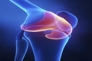 CT Scans for Knee Injuries and Other Knee Conditions