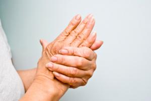 Treatment of Rheumatoid Arthritis