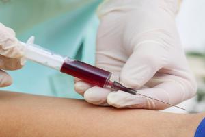 PRP (Platelet Rich Plasma) to Treat Orthopedic Conditions including Osteoarthritis
