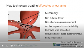 eCLIPs - New technology treating bifurcation aneurysms