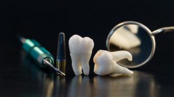 dental traumatic tooth repair