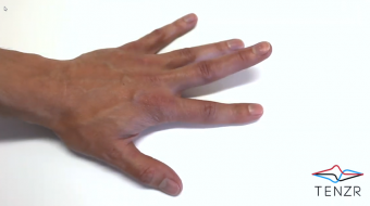 Finger Lifts - Isolated Finger Extensions TENZR™ Health : Contact us for a program.