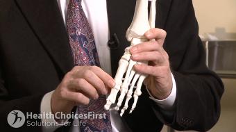 Dr. Alastair Younger, MB, Ch.B, M.Sc, Ch.M, F.R.C.S.(C), discusses How an Orthopaedic Surgeon Can Help You With Foot Pain and Bunionswhat causes bunions and how they are treated.
