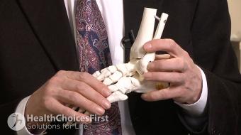 Dr. Alastair Younger, MB, Ch.B, M.Sc, Ch.M, F.R.C.S.(C), Orthopaedic Foot and Ankle Surgeon, discusses What Are Your Surgery Options for Ankle Arthritis
