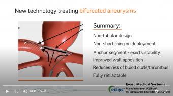 screenshot at eclips new technology treating bifurcated aneurysms health choices first