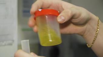 urine test